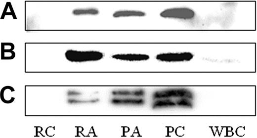 Figure 4. Western blot for calumenin, cyclophilin A, and secretogranin III. The presence of calumenin (A), cyclophilin 4 (B), and secretogranin III (C) was confirmed in lysates from control (platelet control, PC) and thrombin-activated (platelet activated, PA) platelets, as well as the thrombin-activated releasate (releasate activated, RA). These proteins were not found in the supernatant from unactivated platelets (releasate control, RC). In addition, SgIII and calumenin were not detected in a crude leukocyte lysate (WBC), although cyclophilin 4 was present in low amounts.