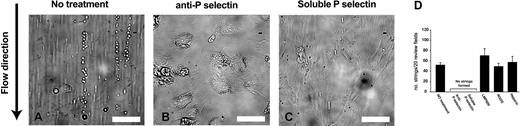 Figure 1. The formation of ULVWF–platelet strings under flow condition was blocked by anti–P-selectin antibody or soluble P-selectin. HUVECs were stimulated with histamine in the absence or presence of a polycloncal anti–P-selectin antibody, purified human P-selectin, the monoclonal anti-αvβ3 antibody LMP609, RGDS peptide, or heparin for 15 minutes at room temperature. Washed platelets suspended in Ca++, Mg++-free Tyrode buffer were then perfused over the stimulated endothelial cells at 2.5 dyn/cm2 for 2 minutes at 37°C. The number of ULVWF–platelets strings was then counted in 20 continuous fields of 400 × (A, bar = 100 μm). Results in (D) are from 12 separate experiments. Data are mean ± SEM.