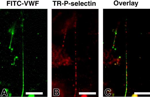 Figure 2. ULVWF strings colocalized with P-selectin on endothelial cells. HUVECs were stimulated with histamine and perfused with PBS buffer containing 1% paraformaldehyde at a flow rate of 0.1 mL/min for 20 minutes. After perfusion, cells were stained with FITC-conjugated monoclonal anti-VWF and Texas Red–conjugated polyclonal anti–P-selectin antibodies. ULVWF formed stringlike structures in the absence of platelets (A). P-selectin expression was in clusters (B), and most of these P-selectin clusters were located along the ULVWF strings (C). The figure represents 8 independent experiments (bar = 100 μm).