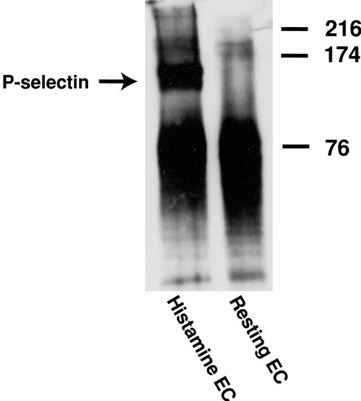 Figure 5. Coimmunoprecipitation of P-selectin with anti-VWF antibody from stimulated HUVECs. Histamine-stimulated and unstimulated HUVECs were lysed with a digitonin lysis buffer. ULVWF multimers were precipitated from the cell lysates by the monoclonal anti-VWF antibody 6G1, and coimmunoprecipitation of P-selectin with ULVWF was determined by Western blot using a polyclonal anti–P-selectin antibody. The figure represents 3 independent experiments.