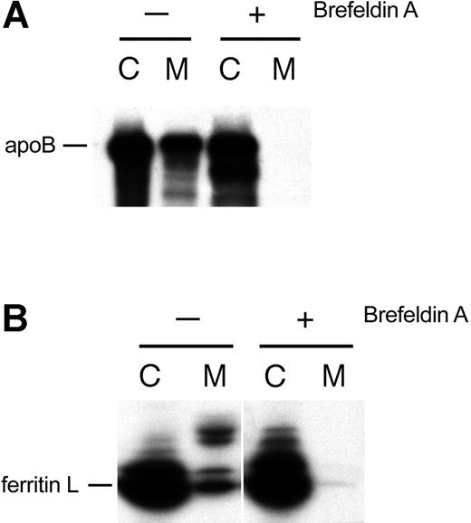 Figure 3. Ferritin L traverses the classical secretory route. (A) BFA inhibits the secretion of apolipoprotein B (apoB), which is secreted via the classical secretory route. AdX-FL–infected HepG2 cells were left untreated (-) or treated with 1 μg/mL BFA (+). The cell lysates (labeled C) and medium (M) were collected, and one aliquot of each was subjected to immunoprecipitation with polyclonal antibodies against apolipoprotein B. (B) BFA inhibits the secretion of ferritin L. Aliquots of the cell lysate (labeled C) and medium (M) from panel A were immunoprecipitated with polyclonal antibodies against ferritin.