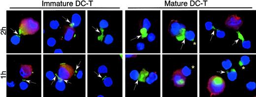 Figure 6. Viral transfer from MDDCs to CD4+ lymphocytes. Immature or mature MDDCs were exposed to AT-2 SIV CP-mac, and cell-free virus was washed away. AT-2 SIV–bearing DCs were mixed with autologous CD4+ T cells, centrifuged, and incubated to allow conjugate formation. The cells were then incubated at 37°C for 1 or 2 hours (5-7 donors) before the cells were adhered to alcian blue–treated slides. Staining for SIV envelope (green) and cellular nuclei (blue) was performed as outlined in Figure 3. DCs were identified by staining with PE-conjugated anti–HLA-DR (red). Arrows show transfer of SIV envelope between DCs and T cells, and arrowheads denote cell-to-cell transmission between T cells. Asterisks show SIV envelope on T cells, often remote from the DC–T-cell synapse. Virus staining at the DC–T-cell synapses was seen in all donors after incubation at 37°C, but the extended virus-positive “bridges” between DCs and T cells were observed more infrequently. Murine and human Ig controls showed no staining. Original magnification, × 100.