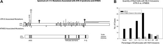 Figure 5. Acquired versus constitutional ATRX mutations. (A) Comparison of the spectrum of ATRX mutations described in boys with ATR-X syndrome with those found in ATMDS. The ATRX gene (top, with introns not to scale) is aligned with ATRX protein (bottom) to allow comparison of mutation site with functionally important protein domains such as the ADD (ie, ATRX, DNMT3, DNMT3L) zinc-finger domain (ADD includes a C2-C2 type of zinc finger and the closely located PHD motif), helicase domains, P-box, and Q-box. ATR-X–associated mutations are annotated above the schematic representation of the ATRX gene at the mutation loci, while mutations associated with ATMDS are denoted below. • represents mutations predicted to cause protein truncation (ie, frame shifts and nonsense mutations) and null mutations, whereas ○ represents amino acid changes, including in-frame insertions and deletions. Unfilled boxes denote the newly described -14G>A polymorphism and 2692G>C; D898H base-pair change of uncertain significance as described in the text. (B) Comparison of the fraction of erythrocytes containing HbH inclusions in 118 patients with ATR-X syndrome with the fraction detected in the 18 patients with ATMDS analyzed in this study. Transfused and untransfused patients with ATMDS are tallied together; the possibility of dilution by donor erythrocytes contributing to artifactually decreased HbH-containing cells in the former group should be recognized.