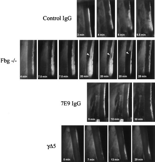 Figure 4. Dynamic demonstration of thrombus embolization in fbg–/– mice compared to control, 7E9-treated, and γΔ5 mice. Characteristics of thrombus growth after FeCl3 injury. Single frames from the videos recorded through one eyepiece of the surgical microscope are shown, with blood flow proceeding from top to bottom. Thrombus formation at the site of the injury began rapidly in the mouse treated with control hamster IgG and the thrombus grew steadily more compact and dense without any significant macroscopic embolization. In the fbg–/– mouse, early platelet deposition was similar to that in the control mice, but the deposited platelets formed small loose thrombi that steadily embolized downstream from the site of the injury. Even though the thrombi at the site of the injury grew large, they were very unstable and repeatedly embolized. In the animal shown, a large, nearly occlusive thrombus formed after 20 minutes, but it soon began to stretch at one site (arrowhead) and then abruptly peeled off near its attachment to the vessel wall and embolized downstream. This particular embolus occluded the distal circulation, leading to transient cessation of blood flow. New thrombus deposition and additional embolization was visible at the site of injury 8 minutes later. Both 7E9-treated mice and γΔ5 mice differed dramatically from the control and fbg–/– mice in developing only small mural thrombi at the site of injury and only minimal embolization was observed. Original magnification × 15.