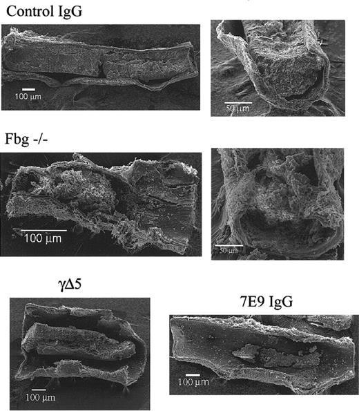 Figure 5. Compared to control, fbg–/– mice produce loosely packed large thrombi and both 7E9-treated and γΔ5 mice produce small mural thrombi. Scanning electron micrographs of carotid arteries of a control IgG-treated mouse, a fbg–/– mouse, a 7E9-treated mouse, and γΔ5 mouse 30 minutes after FeCl3 injury. There was a large, dense thrombus in the animal treated with control IgG, a large but loosely packed thrombus in the fbg–/– animal, and smaller mural thrombi in both the γΔ5 mouse and 7E9-treated mouse.