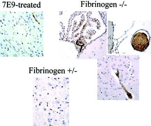 Figure 7. Thrombus formation and embolization in the carotid arteries of fbg–/– mice produce large emboli that occlude large blood vessels in the brain. Immunostaining of brain sections from animals at the end of the experiments with polyclonal antibody to mouse platelets revealed large emboli occluding vessels in brains of fbg–/– animals when compared to the control fbg+/– animal or 7E9-treated animal (original magnification × 20).