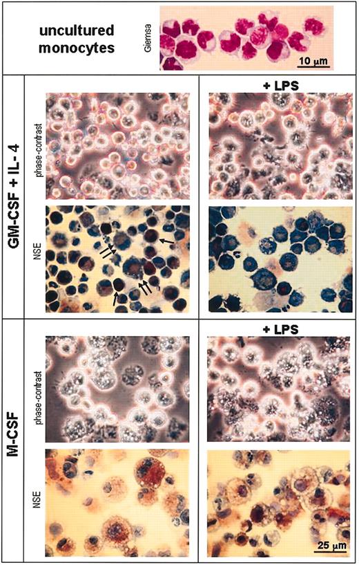 Figure 5. Morphologic analysis of monocytes and day-3 monocyte cultures with GM-CSF plus IL-4 or M-CSF. Cytospin slides from uncultured purified monocytes were stained with Giemsa (lens magnification, × 100; scale bar is 10 μm). Cytospin slides from day-3 cultures of monocytes with GM-CSF plus IL-4 or M-CSF in the absence or presence of LPS were analyzed unstained by phase-contrast microscopy or processed for the detection of NSE and counterstained with toluidine blue (final magnification, × 100; scale bar is 25 μm). Single and double arrows indicate strongly and weakly NSE-positive cells, respectively, corresponding to immature and mature DCs.