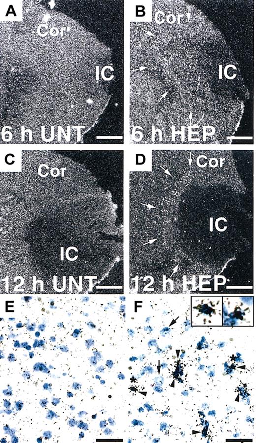 Figure 3. In situ hybridization of tPA mRNA expression in the mouse brain. (A-D) Dark-field photomicrographs show significant up-regulation of tPA mRNA in the border of the ischemic core (IC) at 6 and 12 hours after MCAO in heparin (HEP)–treated WT mice (arrows in B, D) compared with untreated (UNT) WT mice (A, C). Cor indicates cerebral cortex. Bright-field photomicrographs show that increased tPA mRNA levels were expressed in microglial cells (F, arrowheads) but not neurons (F, arrows). Insets are 2.5-fold magnified cells from the area denoted by the asterisk. Scale bars equal 500 μm (A-D) and 50 μm (E-F).