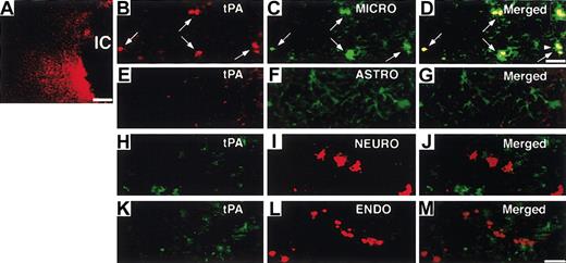 Figure 4. Localization of increased tPA by heparin administration. (A) Immunofluorescence staining shows tPA increased at the border of the ischemic core (IC) at 6 hours after MCAO administration in heparin-treated WT mice. Double labeling of tPA (red; B, arrows) with rabbit anti-tPA and microglial (MICRO) cells (green; C, arrows) with rat antiF4/80, tPA (red; E), and astrocytes (ASTRO; green) (F) with rat anti-GFAP, tPA (green; H) with goat polyclonal antibody, and neuron (NEURO; I) with rabbit antineurofilament polyclonal antibody, tPA (green; K), and endothelial cells (ENDO; red) (L) with polyclonal rabbit anti-VWF in the ischemic border zone. Merged images indicate tPA was expressed in microglial cells (D, arrows) but not in astrocytes (G), neurons (J), or endothelial cells (M). Inset in panel D is 1.4-fold magnified cells from the area denoted by the arrowhead. Scale bars equal 300 μm (A), 5 μm (B-D), and 12.5 μm (E-M).