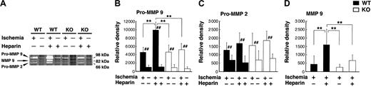 Figure 5. Zymogram shows that heparin administration induced MMP 9 up-regulation. (A) Zymographic analysis of protein extract from ischemic and nonischemic brains of WT and tPA KO mice at 48 hours after MCAO. (B-D) Densitometric analysis of zymographic gels. Pro–MMP 9 (B) and pro–MMP 2 (C) levels were significantly increased in the ischemic hemispheres in WT and tPA KO mice. The increase in pro–MMP 9 was exacerbated by heparin administration in WT mice but not in tPA KO mice (B). The active form of MMP 9 was detected only in the ischemic hemispheres and was significantly increased in heparin-treated WT mice (D). Values are means ± SD (n = 5). **P < .01; ##P < .01 compared with contralateral hemispheres.
