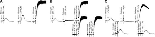 Figure 4. LPA synergizes with ADP, epinephrine, and serotonin in inducing aggregation of washed platelets: different effects of ADP receptor antagonists. Washed human platelets were stimulated with 1-acyl-LPA (16:0) and ADP (A); 1-acyl-LPA (16:0) and epinephrine (ADR) (B); and 1-acyl-LPA (16:0) and serotonin (5-HT) (C) alone or in combination. The synergistic aggregation induced by LPA plus serotonin, but not LPA plus epinephrine was inhibited by MRS2179 or AR-C69931MX.