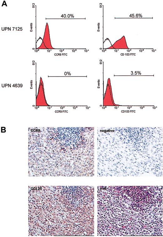 Figure 1. Unique expression of CCR9 and CD103 on the leukemic cells of patient 7125. Multicolor flow cytometry was carried out on a peripheral blood sample obtained at diagnosis using a panel of chemokine receptor- and homing molecule-specific antibodies in combination with markers for T cells. (A) The unique expression of CCR9 and CD103 on the blast cells from patient 7125 is shown (top panel). The bottom panel shows a representative result for expression of these same receptors as found on T cells of 10 other T-ALL patients. Open histograms indicate level of control staining; red histograms, specific staining. Brackets and percentages denote the fraction of antibody-positive cells. (B) Immunohistochemistry was performed on the tumor cell infiltrate in the ileum of patient 7125. Using an anti-CCR9 polyclonal antibody and DAB detection (brown) there was clear positivity of the tumor cells for CCR9. The specificity of the CCR9 staining was confirmed by omitting the CCR9 antibody as a negative control. Furthermore, immunohistochemical staining using an anti-CCL25/TECK monoclonal antibody and NovaRed detection revealed a high expression of this CCR9 ligand in the tumor mass. The lower right picture shows hematoxylin and eosin (H+E) staining of the same area of the affected ileum at relapse. Original magnification, × 250.