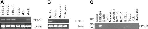 Figure 1. RT-PCR of primary hematopoietic cell populations for EPAC1 and 2. (A) RT-PCR for EPAC1 of cDNA derived from B-CLL, T-CLL, ALL, and mantle-cell lymphoma cells. As a control, cDNA was also amplified for actin. (B) Same RT-PCR analysis as for panel A except that cDNA were derived from purified human B cells, T cells, neutrophils, and monocytes. (C) Same analysis as for panels A and B but using oligonucleotides specific for amplification of human EPAC2. The cDNA from HEK-293 cells was used as a positive control.