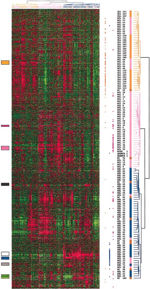 Figure 1. Hierarchical clustering of gene-expression data. Measurements of gene expression from 122 microarray analyses of the 101 nonfollicular small B-cell lymphoma samples of the preliminary group, and the 2 mantle cell lines (NCEB; GRANTA) are depicted. Each column represents the genomic profile of the 2533 expressed genes for one tumor, and each row represents the relative level of expression of one cDNA clone. Red indicates a high level of expression of messenger RNA of the given gene in the tumor, as compared with the median value of this gene, and green indicates a low level of expression, according to the color scale. Gray indicates missing data. Correlated genes are grouped across the samples into clusters localized by the colored boxes. The dendrogram, reported also at the top of the hierarchical clustering, lists the samples studied and provides a measure of the relatedness of gene expression in each sample. SLL cases are colored in orange, MZL cases in blue, MCL cases in pink, and cases reclassified as borderline cases in brown. The dots at the right side of the hierarchical clustering represent the genes that significantly discriminate the 3 entities. The orange dots represent the genes that discriminated the SLL entity, the blue dots the MZL entity, and the pink dots the MCL entity.