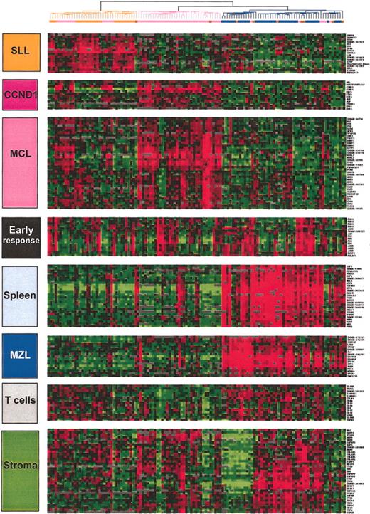 Figure 2. Characteristic gene clusters. Some of the correlated genes grouped into clusters and noted at the left side of the hierarchical clustering figures are reported. They correspond either to a specific type of contaminating cell (T cells) or a tissue type (stroma, spleen). The gene expression of 3 clusters were more specifically related to the 3 lymphoma entities: SLL, MZL, and MCL. SLL indicates small lymphocytic lymphoma; MZL, marginal zone lymphoma; MCL, mantle cell lymphoma; BC, borderline cases; CCND1, cyclin D1. Gene names are available on the Blood website as supplemental data (Table S1); see the Data Set link at the top of the online article.