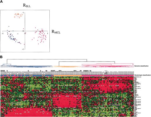Figure 3. Partition for SLL, MZL, MCL, and borderline samples using the 44-genes predictor. (A) Preliminary group samples were correlated to SLL, MZL, and MCL mean profiles. The horizontal axis represents correlations with the MCL mean profile (RMCL) and the vertical axis represents correlations with the SLL mean profile (RSLL). The SLL samples are represented in orange, the splenic MZL samples in blue, and the MCL samples in pink. Cases reclassified as borderline cases are represented in brown. Three of the 6 cases were hybridized twice. Each axis represents the positive value of one subtype. (B) Gene-expression data of the 44 selected genes used for the diagnostic predictor. All samples, the preliminary group, and the validation group samples were clustered according to the expression data of the 44 genes of the diagnostic predictor. Validation group samples were blind analyzed and are marked with a black dot. Note the small branch on the left side of the dendogram containing 4 unpredictable samples. See Table S2 for gene names.