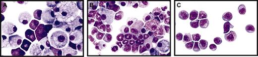 Figure 4. Mut10-expression alters the kinetics but does not block the differentiation of murine BM cells. (A-C) Giemsa-stained cytospins of liquid cultures maintained for 14 days after infection with either control FMEV-GFP (A), FMEV-mut10 (B), or MPEV-CRE vectors (C) in SCF, IL3, FLT3, and IL11. (A) Cultures infected with a control vector consist predominantly of macrophages and mast cells, typical for the end-stage of long-term cultures of hematopoietic cells. (B) Cells infected with the FMEV-mut10 vector display a spectrum of maturing monocytes/macrophages and promyelocytes/metamyelocytes. (C) Cells lacking C/EBPα due to recombination of the conditional gene targeted alleles remain in an undifferentiated myeloblastic or early promyelocytic stage. Original magnification, × 560.