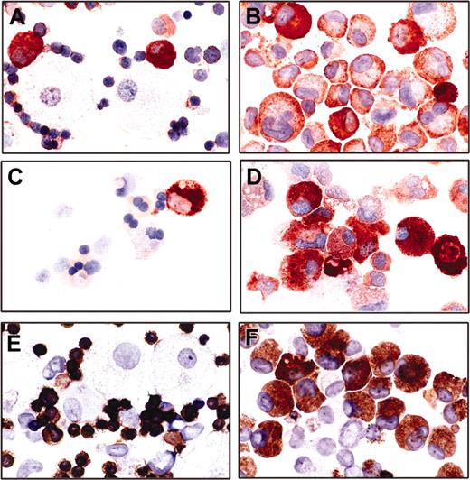 Figure 7. Immunocytochemical demonstration of lineage-specific cell marker expression of infected cultures. Cytospins of day-12 colony assays from human CB cells infected with a control (A,C,E) or mut10 carrying vector (B,D,F) were subjected to immunocytochemical staining. Mut10-transduced cells with an abnormal promyelocytic morphology exhibit a promiscuously positive immunoreactivity for myeloperoxidase (99% positive; B), lysozyme (76% positive; D), and glycophorin A (71.6% positive; F). The control cells show a lineage restricted immunoreactivity of myeloperoxidase (A), lysozyme (C), or glycophorin A (E) in promyelocytic, monocytic, and erythroid cells, respectively. Original magnification, × 560.
