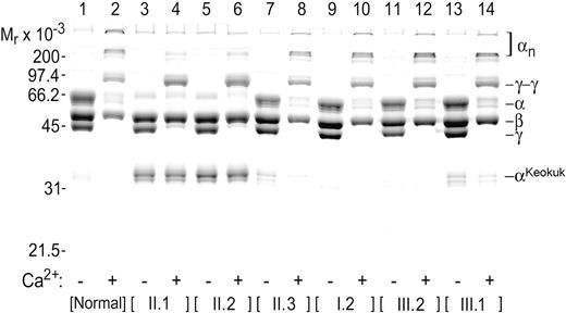 Figure 2. Electrophoretic profile of fibrin clots. SDS-PAGE showing fibrin chain profiles of clots generated in the absence (odd-numbered lanes) and presence (even-numbered lanes) of Ca2+ from the citrated plasma of II.1, II.2, their mother (I.2), brother (II.3), and his children (III.1, III.2). II.1 and II.2 lack normal α chain, and a much shorter constituent chain (αKeokuk) that cannot produce cross-linked αn polymers is seen in II.1, II.2, II.3, and III.1 samples.