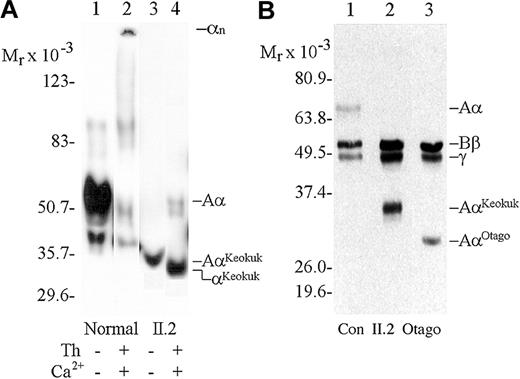 Figure 3. Characterization of aberrant Aα chain. (A) Immunoblot of plasma, after SDS-PAGE, with antibody to Aα241-476 before and after the addition of thrombin. Lanes 1 and 2, normal control; lanes 3 and 4, patient II.2. The patient lacks normal Aα chains, but fibrinopeptide A is successfully removed from the N-terminus of the defective chain by thrombin, suggesting C-terminal truncation. (B) Immunoblot of SDS-PAGE using antiserum to whole fibrinogen. Lane 1, normal plasma; lane 2, patient II.2; lane 3 homozygote for AαOtago truncation with a predicted mass of 30 862 Da.
