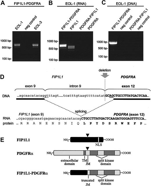Figure 1. Fusion of FIP1L1 to PDGFRA in the EOL-1 cell line. Detection of the FIP1L1-PDGFRA fusion transcript in the EOL-1 and EOL-3 cell lines (A), detection of FIP1L1 expression in the EOL-1 cell line (B), and amplification of the FIP1L1-PDGFRA fusion gene on DNA from the EOL-1 cell line (C). Different transcripts are observed for FIP1L1 and FIP1L1-PDGFRA (A-B) because of alternative splicing. Expressions of PDGFRA-FIP1L1 and native PDGFRA were not detected (B). The sequence of the fusion gene surrounding the deletion is shown at the DNA level, at the RNA level (after splicing), and at the protein level (D). Splice donor and acceptor sites are underlined. A cryptic splice site is used in exon 12 of PDGFRA. Schematic representation of FIP1L1, PDGFRα, and FIP1L1-PDGFRα proteins (E). Points at which the proteins are interrupted by the deletion are indicated by arrowheads.