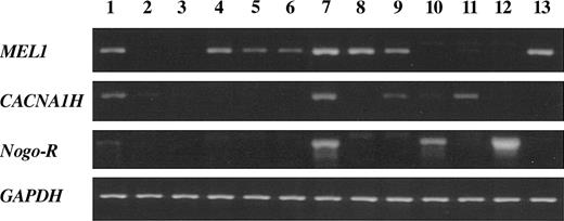 Figure 2. Expression of genes isolated by MCA/RDA in various cell lines. Expression of the MEL1, CACNA1H, and Nogo receptor genes, as identified by MCA/RDA, was analyzed by RT-PCR. Transcripts of the GAPDH gene were used as a control. Lane 1, 293 cells; lane 2, PBMCs; lane 3, activated T cells; lane 4, MT-4; lane 5, ATL-35T; lane 6, ATL-43T; lane 7, ATL-55T; lane 8, ED; lane 9, ATL-2; lane 10, Hut78; lane 11, Jurkat; lane 12, SupT1; and lane 13, Kit225.