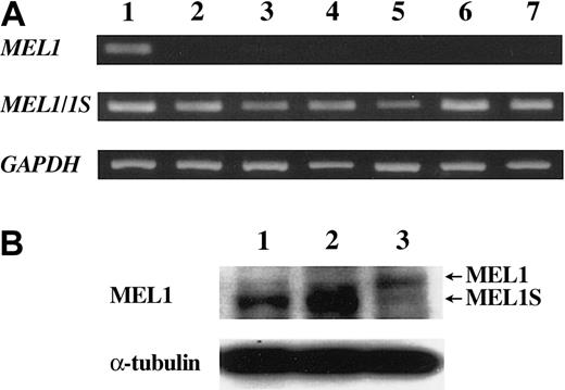 Figure 3. Short form products of the MEL1 gene were expressed in ATL cell lines. (A) Transcription of MEL1 and MEL1S genes. The transcription of MEL1 and MEL1S genes were studied with the specific primers in ATL cell lines and control cell line as follows: lane 1, 293 cells; lane 2, MT-4; lane 3, ATL-35T; lane 4, ATL-43T; lane 5, ATL-55T; lane 6, ED; and lane 7, ATL-2. RT-PCR that could detect both MEL1 and MEL1S gene transcripts revealed the transcription (330 bp) in all cell lines, whereas RT-PCR with primers specific for MEL1 gene detected the transcript (197 bp) only in 293 cells. (B) Western blot analysis of MEL1 and MEL1S. Cell lysates were analyzed by Western blot using antibodies against the MEL1/1S protein. Lane 1, ATL-55T; lane 2, ED; and lane 3, 293 cells.