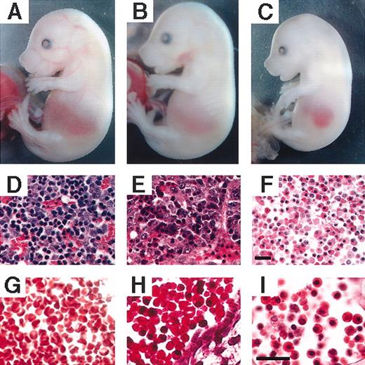 Figure 3. Erythropoiesis in E15.5 V205GR and ΔNFR embryos. Macroscopic appearance (panels A-C) of wild-type (panels A, D, G), V205GR (panels B, E, H), and ΔNFR (panels C, F, I) embryos are shown along with hematoxylin and eosin staining of embryonic liver (panels D-F), and circulating erythrocytes observed in large blood vessels (panels G-H). Scale bars correspond to 20 μm.