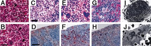 Figure 4. Morphologic abnormalities of V205GR megakaryocytes. (A) (B) Histologic examination of E17.5 liver with hematoxylin and eosin staining. Megakaryocytes in the liver of V205GR embryo (B, arrowheads) are increased in number and larger in size compared with those of wild-type littermate (A arrowhead). Scale bar corresponds to 40 μm. (C)–(H) Histologic examination of wild-type (C, D), V205GR (panels E, F), and G1R (G, H) mouse spleens. Spleen sections with hematoxylin-eosin staining (C, E, G) or AChE staining (D, F, H) are shown. Scale bars correspond to 40 μm (C, E, G) and 300 μm (D, F, H), respectively. (I,J) Electron microscopic analysis of megakaryocytes. Megakaryocytes were prepared from bone marrow of wild-type (I; original magnification, ×3000) and V205GR (J; original magnification, ×2000) mice.