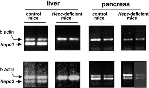 Figure 3. The mRNA level of hepc1 and hepc2 as determined by RT-PCR using liver and pancreatic mRNA from control and hepcidin-deficient mice. Following PCR, the amplified products (171 bp for hepc1 and hepc2, 250 bp for β-actin7) were separated by electrophoresis on 1.5% agarose gel.