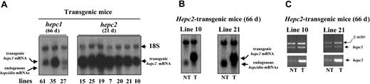Figure 6. Hepcidin mRNA level in transgenic mice constitutively expressing hepc2 as determined by Northern blot and RT-PCR analyses. Twenty micrograms of total liver RNA purified from 66-day-old transgenic mice expressing hepc111 and from 21-day-old transgenic mice expressing hepc2 (A) or from 66-day-old nontransgenic (NT) mice compared with age-matched hepc2-transgenic (T) mice (B) were electrophoresed, blotted, and hybridized with the (32P)-labeled hepcidin probe. This probe reveals both the transgenic hepcidin mRNAs (transgenic hepc1 mRNA and transgenic hepc2 mRNA, top band) and the endogenous hepcidin mRNAs. Note that in the 66-day-old hepc1-transgenic mice the endogenous genes (bottom band) are repressed or reduced (line 27) most likely due to, as reported,15 the hepc1-transgene-induced anemia. (C) Individual expression of hepc1 and hepc2 mRNAs was measured by RT-PCR, as described in “Materials and methods,” in 66-day-old nontransgenic (NT) mice compared with age-matched hepc2-transgenic (T) mice. Following PCR, the amplified products (171 bp for hepc1 or hepc2 and 250 bp for β-actin) were separated by electrophoresis on 1.5% agarose gel.