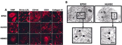 Figure 2. Immunofluorescence analysis and ultrastructural studies. (A) Immunofluorescence analysis of EPDCs, HUVECs, and HBMECs. Cells were stained with antibody against VWF, CD144, CD31, or collagen IV. EPDCs as well as HUVECs and HBMECs take up Dil-Ac-LDL and were positively stained with VWF, CD144, CD31, or collagen IV antibodies. Scale bar equals 5 μm. (B) Ultrastructural studies of EPDCs and HUVECs. EPDCs and HUVECs were fixed and prepared for transmission electron microscopy. Scale bar equals 1 μm. Arrowheads indicate Weibel-Palade bodies.