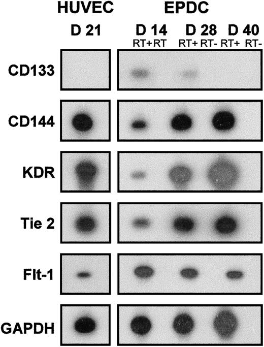 Figure 3. RT-PCR analysis of EPDCs and HUVECs. Expression of CD133, CD144, KDR, Tie-2, Flt-1, and GAPDH mRNA was determined with a 32P-labeled internal probe at days 14, 28, and 40 of culture for EPDCs and at day 21 of culture for HUVECs. RT- was the control realized without reverse transcription before PCR. D indicates day.