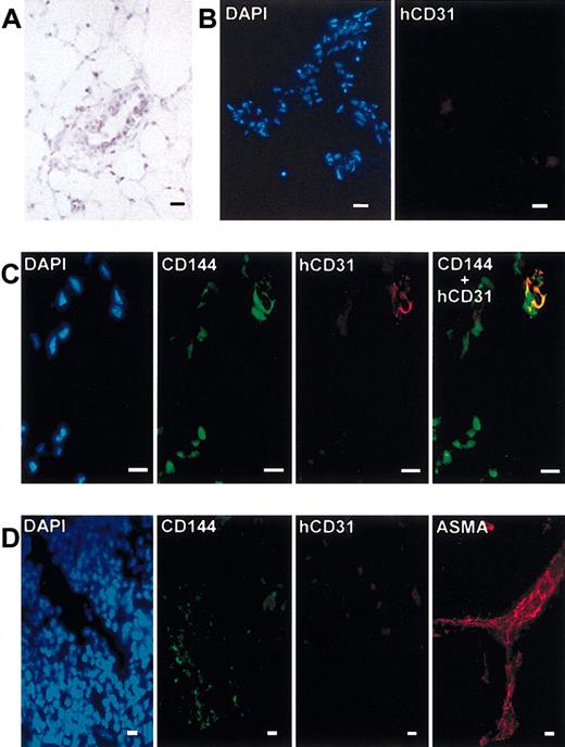 Figure 7. Presence of human endothelial cells in Matrigel plug. (A) May-Grünwald-Giemsa staining of Matrigel cryosection. (B) DAPI (blue) and human CD31 (red) staining of Matrigel cryosections from negative control mice (no CD34+ transplants). (C) DAPI (blue), CD144 (green), human CD31 (red), and double CD144 and human CD31 (yellow) staining of Matrigel cryosection from mice receiving CD34+ transplants. (D) DAPI (blue), CD144 (green), human CD31 (red), and ASMA (red) staining of spleen cryosections. Scale bars equal 10 μm.