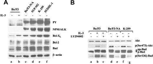 Figure 1. Expression and activation status of Bcl-2 family members in NPM/ALK-expressing cells. (A) Expression and tyrosine phosphorylation of NPM-ALK were evaluated with an anti-ALK monoclonal and antiphosphotyrosine (PY) antibodies in total lysates from pro-B Ba/F3 parental cells cultured in the absence or presence of IL-3 for 18 hours (lanes a-b), in NPM/ALK-expressing cell lines including Ba/F3 cells transfected with NPM/ALK (Ba/F3-N/A; lane c), and the human ALCL-derived cell lines SUP-M2 (lane d), K-299 (lane e), and SUDHL-1 (lane f). Expression levels of Bcl-XL, Bcl-2, and Bad were also assessed. (B) Ba/F3 parental cells were starved without IL-3 for 2 hours (lane a) and then stimulated with IL-3 in the absence (lane b) or presence (lane c) of 25 μM 294002 for 30 minutes. Ba/F3-N/A+ and K-299 ALCL cells were incubated with the same drug concentration (lanes e, g) or vehicle alone (lanes d, f) for 30 minutes. Expression and activation status of AKT and Bad were evaluated from total lysates with anti-total AKT and Bad polyclonal antibodies as well as by using antiphosphoserine-specific antibodies (phospho-Ser473 for AKT and phospho-Ser136 for Bad).
