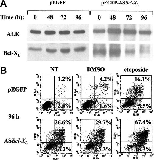 Figure 5. Effect of Bcl-XLL down-regulation on cell survival in K-299 cells. K-299 cells were transiently transfected with a pEGFP control vector (left panels) or ASBcl-XL-GFP plasmid (right panels) encoding full-length Bcl-XL antisense cDNA. Cultures containing at least 60% of transfected cells were used for further analysis by Western blot and apoptosis determination. (A) Western blot analysis of total lysates for the expression of Bcl-XL was performed at the indicated time points after transfection. NPM/ALK levels are presented as a protein loading control. (B) At 80 hours after transfection, cultures were treated for 16 hours with DMSO (middle panels), 10 μM etoposide (right panels), or left untreated (left panels). Apoptosis induction was assessed using an annexin V binding assay and flow cytometric analysis.