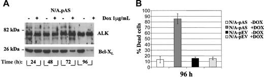 Figure 6. Dox-inducible down-regulation of Bcl-XL in stable pTet-ON transfectants in vitro. (A) Western blot analysis of Bcl-XL expression in a representative Ba/F3-NPM/ALK+ clone (N/A-pAS) cultured in absence/presence of a single dose of doxycycline (Dox 1 μg/mL) for the indicated times. (B) A Ba/F3-N/A.ASBcl-XL antisense-inducible clone (N/A-pAS) and a Ba/F3-NPM/ALK+ clone bearing an empty vector (N/A-pEV) were grown in triplicate in the absence (-Dox) or presence (+Dox) of doxycycline for 4 days. A single dose of doxycycline (1 μg/mL) was added in the culture medium at the beginning of the experiment and replaced after 2 days. Apoptosis was evaluated by AO staining as reported in Figure 4D. Error bars indicate SD.