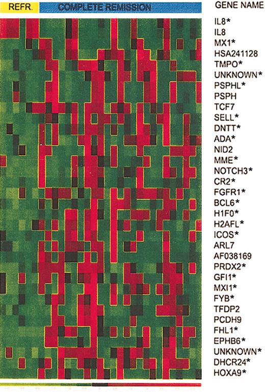 Figure 2. Expression of 34 selected genes in responding versus refractory T-ALL patients. Expression of 34 selected genes in T-ALL from 6 patients who did not respond to induction therapy and 25 patients who achieved CR. Asterisks identify the top 25 genes that provide the smallest prediction error.