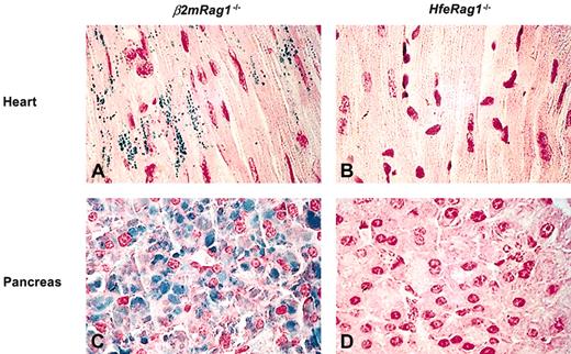 Figure 1. Storage of excess iron in the heart and pancreas of mice after 3 months on a diet supplemented with 2.5% wt/wt carbonyl iron (Prussian blue staining, n = 5). The animals were 5 months old at the end of the experiment. Heart section from representative β2mRag1-/- (A) and HfeRag1-/- mice (B). Pancreas section from representative β2mRag1-/- (C) andHfeRag1-/- mice (D). Original magnification, × 600.