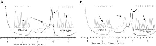 Figure 1. DHPLC elution profiles for the HAMP g175G>C sequence alteration and g212G>A sequence variation compared with wild-type homozygous DNA and the respective sequences. Panel A displays the overlay of chromatograms showing HAMP g175G>C sequence alteration and wild type and the respective sequences. Panel B shows the second alteration profile of HAMP g212G>A and sequences.