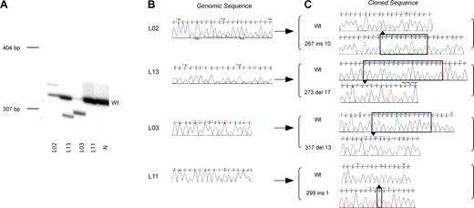 Figure 1. GATA1 exon 2 mutation detection in AMKL patients. (A) A representative polyacrylamide gel illustrates positions of radiolabeled mutant GATA1 exon 2 PCR products with respect to wild-type product (Wt). Genomic DNA from AMKL patients (L02, L13, L03, and L11; Tables 1-2) and a normal sample (N) was used as template. Positions of DNA size markers (in base pairs) are indicated on the left. (B) Direct sequence analysis of GATA1 exon 2 PCR products from genomic DNA from patients L02, L13, L03, and L11 is shown. Note that in patients L02, L13, and L11, there are 2 superimposed sequence traces in portions of the chromatogram indicative of more than one GATA1 sequence in the template. The predominant sequence trace is wild type, while the mutant sequence is a minor trace. Only the mutant sequence trace is seen for patient L03. This reflects the amount of mutant product (relative to wild type) as seen in the polyacrylamide gel in panel A of this figure. (C) Amplified GATA1 exon 2 PCR products from patients L02, L13, L03, and L11 were cloned and sequenced. Sequence chromatograms from mutant and wild-type clones are shown. Nucleotide position 1 is taken from the submitted GenBank sequence of human GATA1 (NM_002049).