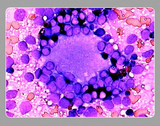 Peter Maslak, Memorial Sloan-Kettering Cancer Center