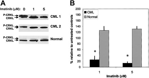 Figure 1. Inhibition of CRKL phosphorylation in CML CD34+ cells by imatinib treatment. CML (n = 6) and normal (n = 3) CD34+ cells (2 × 105) were exposed to imatinib (1 and 5 μM) for 16 hours in medium containing low concentrations of growth factors as described in “Patients, materials, and methods.” Whole-cell lysates were electrophoresed on 10% SDS-PAGE and Western blotted with an anti-CRKL antibody. P-CRKL could be distinguished from nonphosphorylated CRKL by its slower migration. (A) Representative results for 2 CML samples and a normal control sample are shown. (B) Densitometry analysis was performed, and the percentage of phosphorylated CRKL determined as described in “Results.” Means ± SEM of P-CRKL/CRKL ratios for treated cells expressed relative to controls are shown for CML (▪) and normal (▦) samples. Significant differences in paired t tests for treated CD34+ cells compared with untreated controls are indicated (*P < .005).