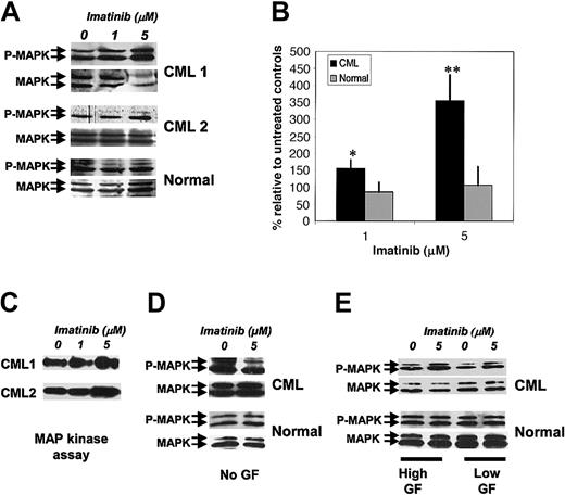 Figure 2. Enhancement of p42/44 MAPK phosphorylation in CML CD34+ cells by imatinib treatment. (A) CML and normal CD34+ cells (2 × 105) were exposed to imatinib (1 and 5 μM) for 16 hours in medium containing low concentrations of GFs. Whole-cell lysates were prepared, electrophoresed on 10% SDS-PAGE, and Western blotted with antibodies to dual phosphorylated p42/44 MAPK (P-MAPK). Blots were stripped and reprobed with antibodies to total p42/44 MAPK (MAPK). Representative results for 2 CML samples and a normal control sample are shown. (B) Cumulative results for 6 CML and 3 normal samples are shown. P-MAPK/MAPK ratios were calculated by densitometry. Mean ± SEM of P-MAPK/MAPK ratio for treated cells expressed relative to controls is shown for CML (▪) and normal (▦) samples. Significant differences in a paired t test for treated CD34+ cells compared with untreated controls are indicated (*P < .07; **P < .02). (C) MAPK kinase assays were performed on CML CD34+ cells cultured with low concentrations of GFs in the absence and presence of imatinib. The p42/44 MAPK was immunoprecipitated, and in vitro kinase assays were performed with the use of an ELK-1 fusion protein as substrate followed by Western blot with an anti–phospho-ELK-1 antibody. Representative results for 2 CML samples are shown. (D) Results of Western blotting for P-MAPK and MAPK in CML and normal CD34+ cells cultured with or without imatinib (5 μM) in medium without addition of GFs. (E) Results of Western blotting for P-MAPK and MAPK in CML and normal CD34+ cells cultured with or without imatinib (5 μM) in medium containing high (25-fold higher) compared with low concentrations of GFs.