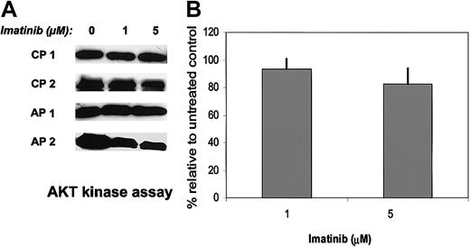 Figure 5. Effects of imatinib on activities of AKT kinase in CML samples. AKT kinase assays were performed on CML CD34+ cells cultured with or without imatinib (1 and 5 μM) for 16 hours in medium containing low concentrations of GF. AKT was immunoprecipitated, and in vitro kinase assays were performed with the use of a GSK-3 fusion protein as substrate followed by Western blotting with an anti–phospho–GSK-3α/β antibody. The difference between imatinib treated cells and untreated cells was not significant (P = .4 for 1 μM imatinib; P = .18 for 5 μM imatinib). (A) Representative results for 2 CP and 2 AP patients. (B) Pooled results for treated cells relative to controls is shown (mean ± SEM, n = 6).