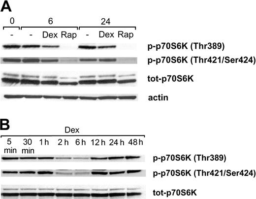Figure 4. The effect of rapamycin and dexamethasone on phosphorylation of p70S6K at Thr389 and Thr421/Ser424. (A) Karpas 707 cells were treated with rapamycin and/or dexamethasone. At 0, 6, and 24 hours cells were lysed, and extracts were subjected to analysis by Western blotting using antibodies specific for the p70S6K phosphorylation sites Thr389 and Thr421/Ser424. (B) Karpas 707 cells were treated with dexamethasone at indicated times followed by Western blotting analysis of p70S6K phosphorylation as described earlier.