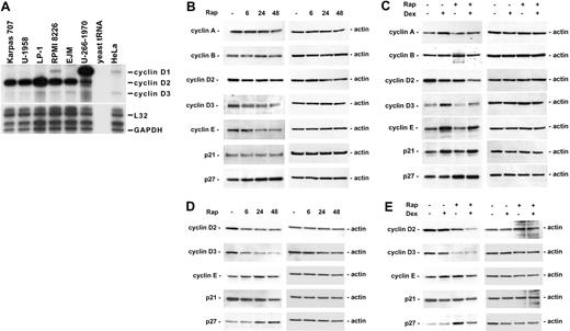 Figure 5. The effect of rapamycin and dexamethasone on cell cycle regulatory proteins. (A) Exponentially growing MM cells were harvested, and total RNA was isolated. RPA was performed by using the multiprobe template hCYC-1. (B-C) Karpas 707 cells or (D-E) U-1958 cells were treated with either (B,D) rapamycin for 6, 24, and 48 hours or (C,E) rapamycin and/or dexamethasone for 24 hours. Cells were lysed and extracts were analyzed by Western blotting by using antibodies specific for p21, p27, and the cyclins A, B, D2, D3, and E.