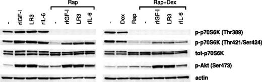 Figure 9. The effects of survival factors on p70S6K and Akt phosphorylation in cells pretreated with rapamycin and/or dexamethasone. Karpas 707 cells were pretreated with rapamycin in the absence or presence of dexamethasone for 1 hour, before incubation with rIGF-I, LongR3-IGF-I (LR3), or rIL-6 for 10 minutes followed by lysis. The extracts were analyzed by Western blotting using antibodies specific for the p70S6K phosphorylation sites Thr389 and Thr421/Ser424 and the Akt phosphorylation site Ser473.