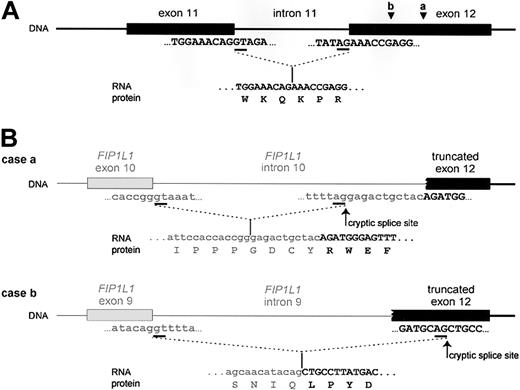 Figure 3. Fusion of FIP1L1 to PDGFRA involves the use of cryptic splice sites. (A) Splicing of exon 11 to exon 12 as it occurs in wild-type PDGFRA. (B) Splicing of FIP1L1 exons to the truncated exon 12 of PDGFRA as observed in 2 different HES patients. As the normal splice site in front of exon 12 is deleted, cryptic splice sites in the introns of FIP1L1 (as in case a) or within exon 12 (as in case b) are used to generate in-frame FIP1L1-PDGFRA fusions. As a result, the fusion protein sometimes contains a few extra amino acids derived from an intronic sequence of FIP1L1 (as in case a). Sequences from FIP1L1 are shown in lowercase letters and in gray; PDGFRA sequences are shown in capital letters and in black. Introns are depicted as lines; exons are shown as blocks. Splice sites are underlined in the sequence. The spliced RNA sequence and corresponding protein sequence are shown under the DNA. Cryptic splice sites are indicated with an arrow. Arrowheads indicate where the breakpoints are located in exon 12 of PDGFRA in cases a and b.