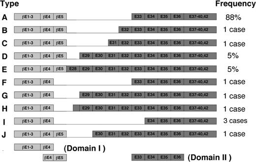 Figure 7. Schematic diagram of fusion variants of β/SMMHC described by van Dongen et al.28 The exon numbers have been changed due to recent completion of the structural analysis of MYH11 gene (GenBank accession no. AB020673). Adapted from van Dongen et al28 with permission; copyright Nature Publishing Group (http://www.nature.com/).